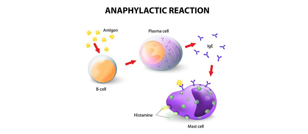 Anaphylaxis Symptoms - Food allergies and anaphylaxis - know the triggers and ... : Severe anaphylactic reactions outside hospital: